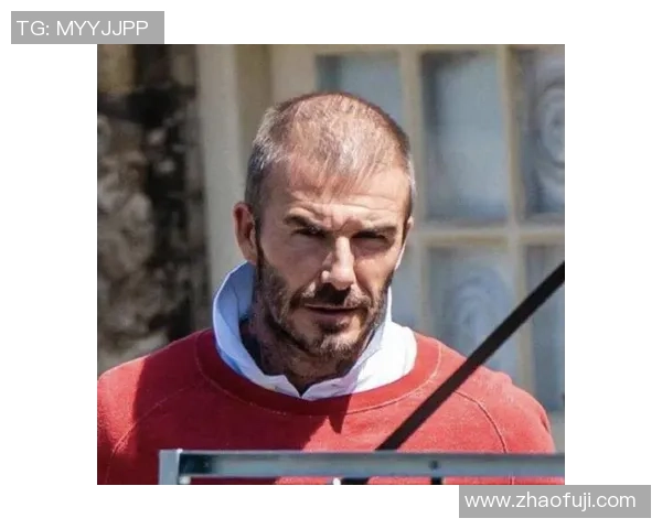 德国足球明星秃顶现象揭秘：从球场到时尚的转变与影响